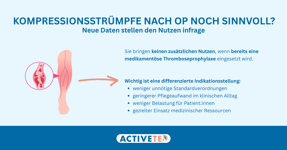 Kompressionsstrümpfe nach der Operation: Brauchen sie wirklich alle?